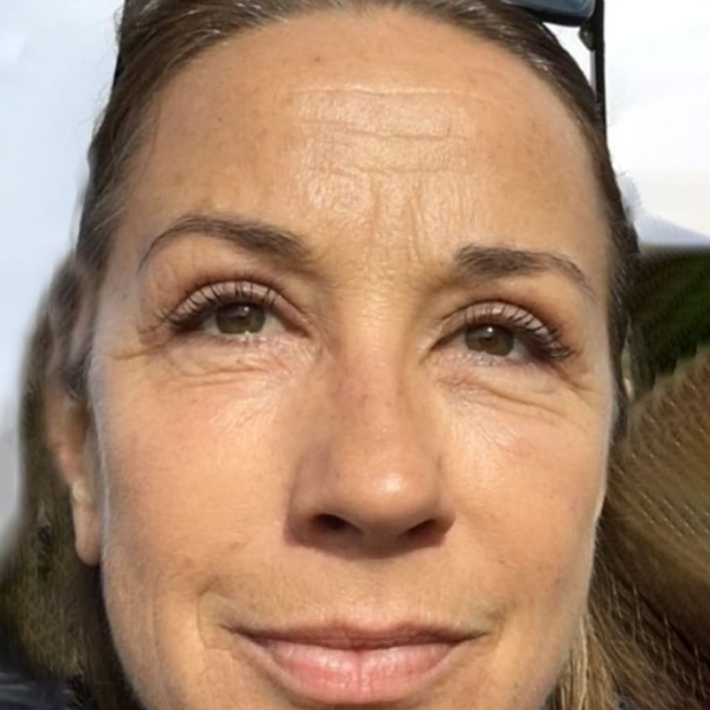 Patch occhi al collagene e peptidi