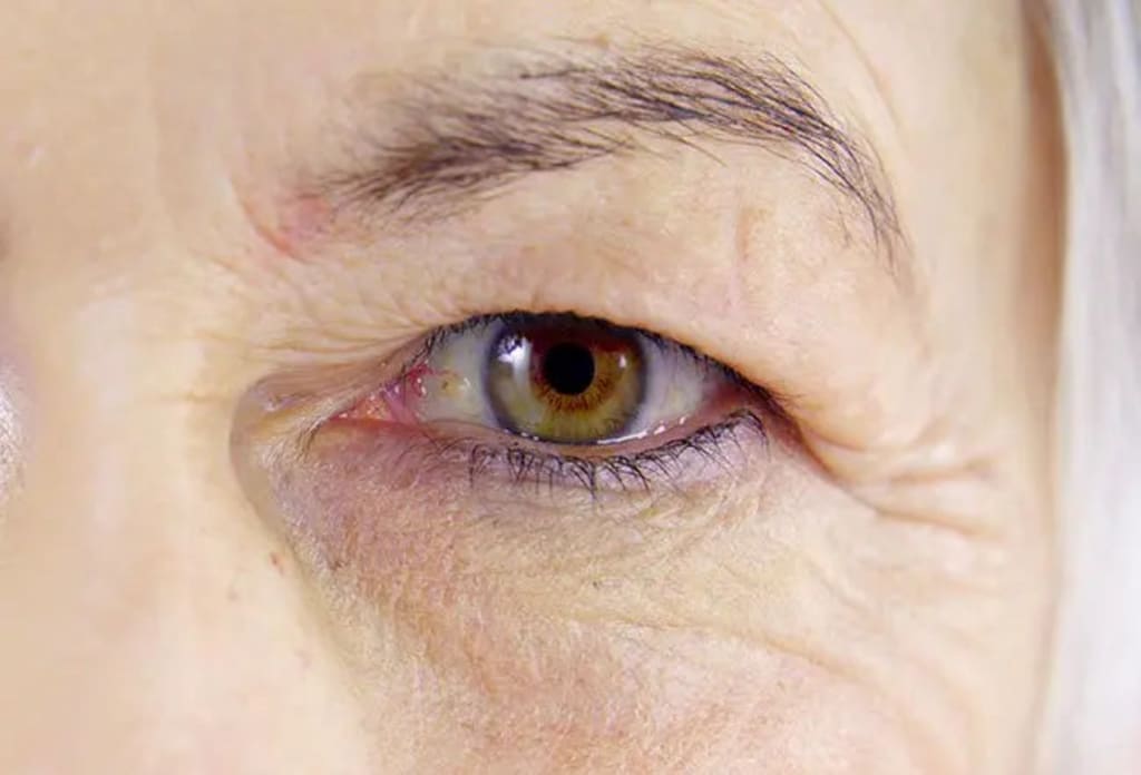 Patch occhi al collagene e peptidi