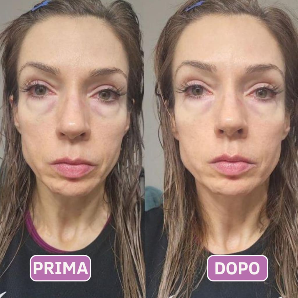 Patch occhi al collagene e peptidi