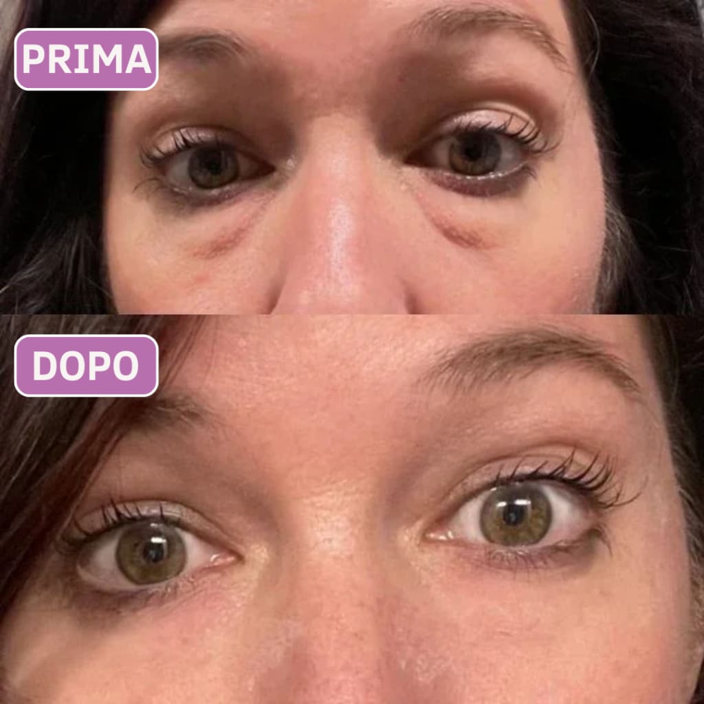 Patch occhi al collagene e peptidi